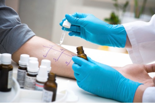 What Is Allergy Testing?