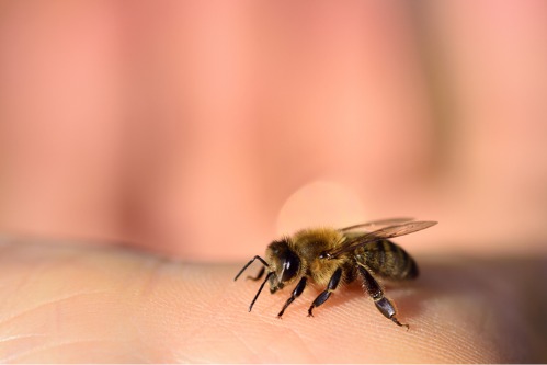 When To See A Doctor For A Bee Sting Reaction